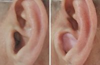 ThermaFit combined with Ohropax earplugs